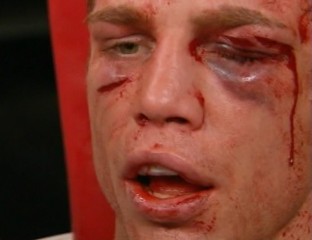 ボクシング世界戦  顔面が崩壊していくボクサー